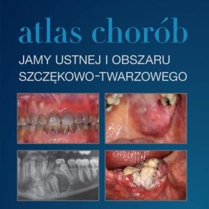Atlas Chorób Jamy Ustnej I Obszaru Szczękowo-Twarzowego