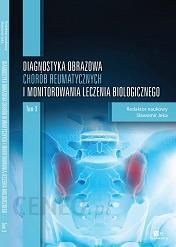 Diagnostyka obrazowa chorób reumatycznych i monitorowania leczenia biologicznego. Tom 3