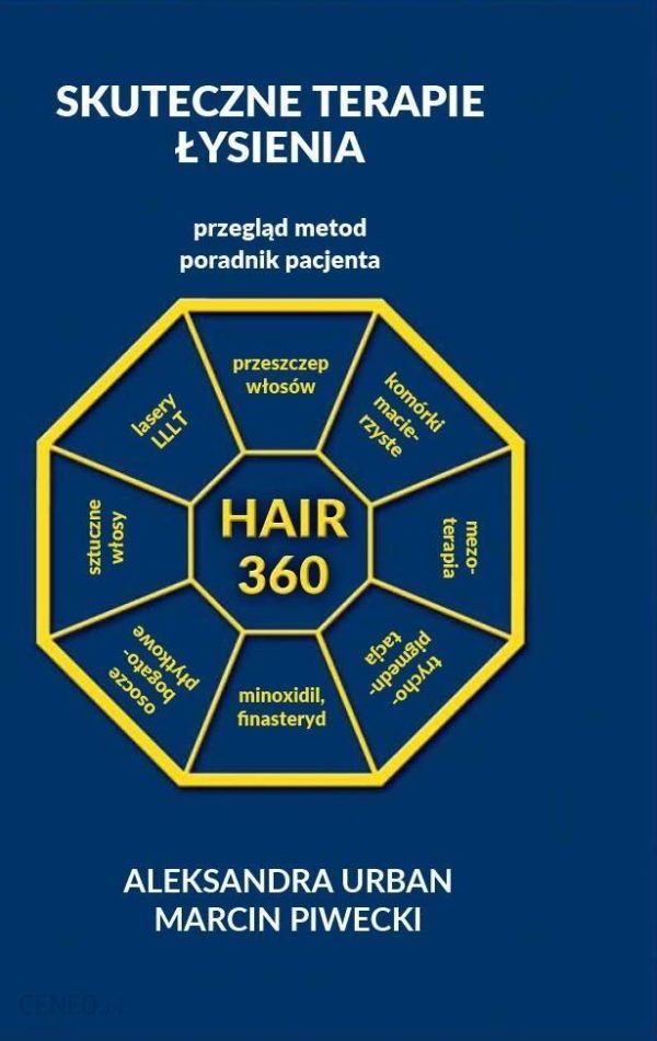 Hair 360 Skuteczne Terapie Łysienia Przegląd Metod