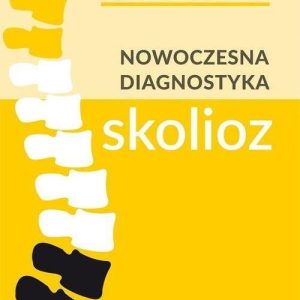 Nowoczesna diagnostyka skolioz