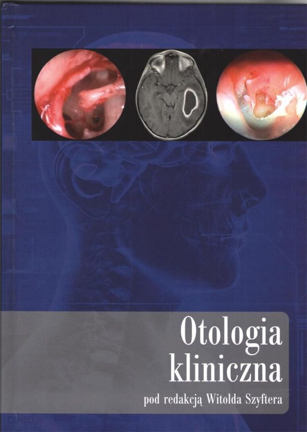 Otologia kliniczna