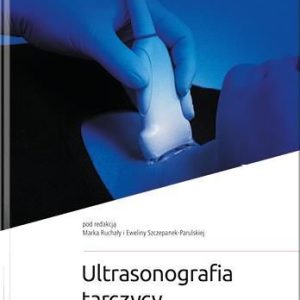 Ultrasonografia tarczycy w praktyce klinicznej