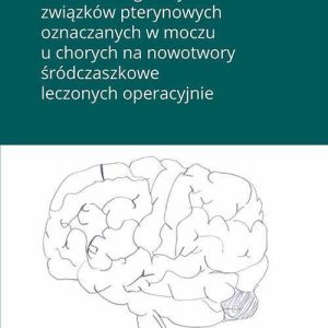 Wartość diagnostyczna związków pterynowych oznaczanych w moczu u chorych na nowotwory śródczaszkowe leczonych operacyjnie