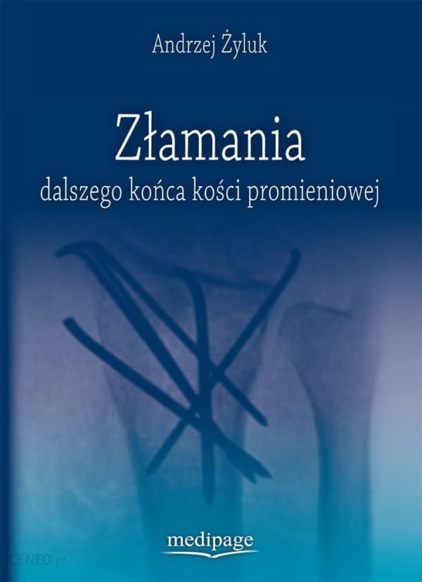 Złamania Dalszego Końca Kości Promieniowej. Andrzej Żyluk