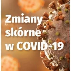 Zmiany Skórne W COVID-19